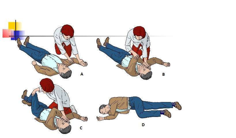 Postopek namestitve v stabilni bočni položaj